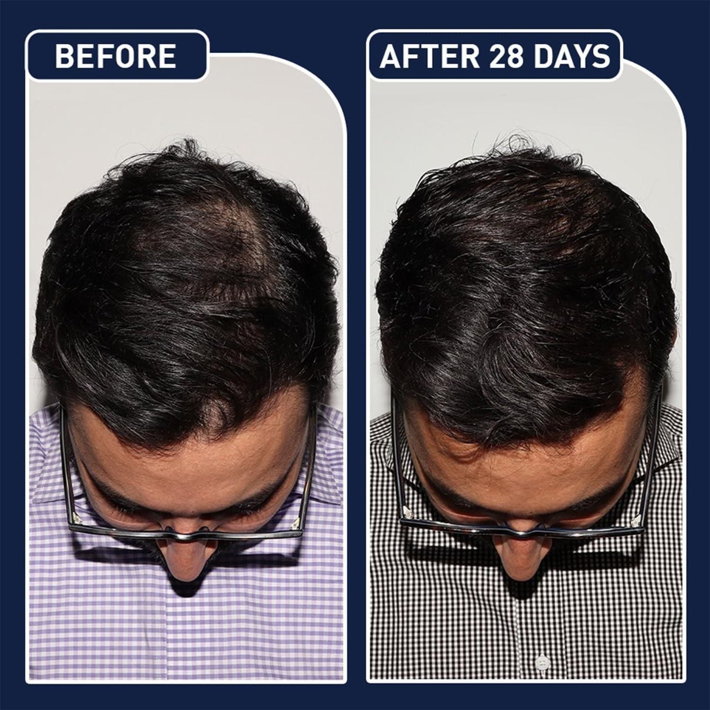 FEGPLUS Hair Growth Spray 50ml