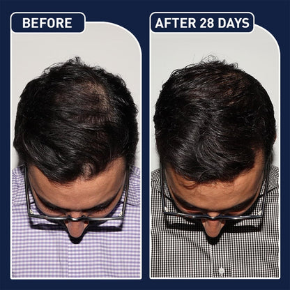 FEGPLUS Hair Growth Spray 50ml