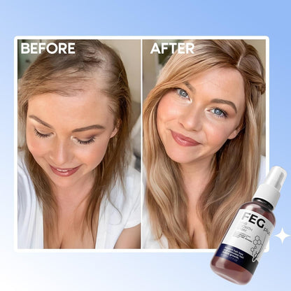 FEGPLUS Hair Growth Spray 50ml